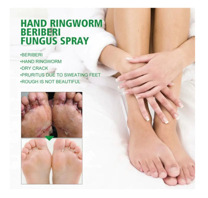 Spray Antihongos -HerbalFoots